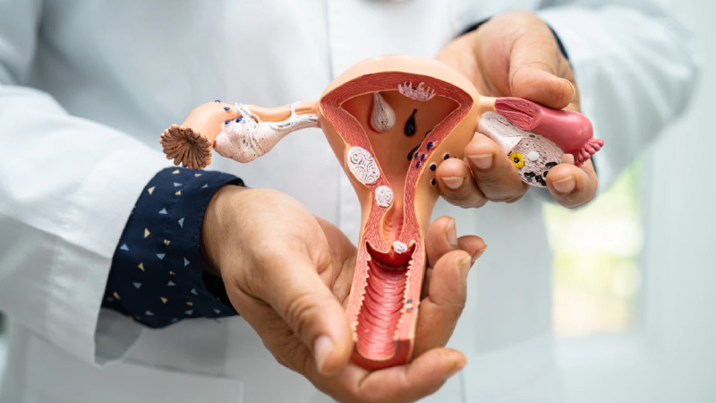 uzmani anlatti her on kadindan birinde polikistik over sendromu gorulebilir cFhf8Sj6