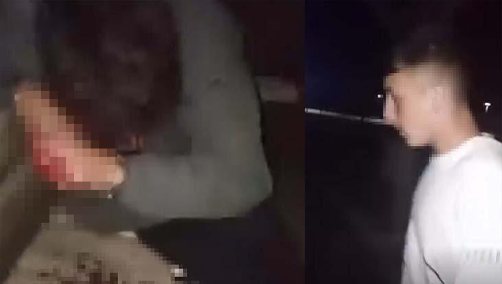 lise ogrencileri arasinda kanli kavga arkadasini parka cagirarak darbetti u3An28Y7